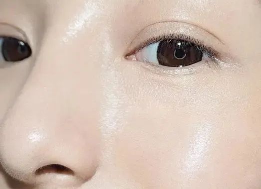 打水光針常見(jiàn)的問(wèn)題有哪些？