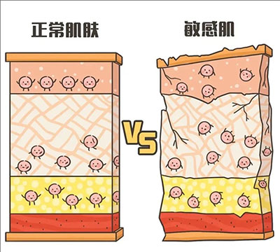 敏感性皮膚產(chǎn)生的原因是什么？