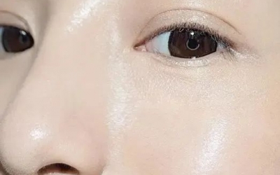 打水光針常見的問題有哪些？