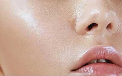 臉上光出油是什么原因？