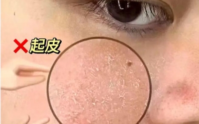 化完妝后臉上起皮怎么補(bǔ)救？